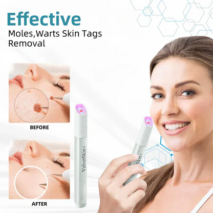 Thekoec® All-in-One CO₂ Laser Eraser Pen | Removes Moles, Warts, Skin Flaws & Pigmentation