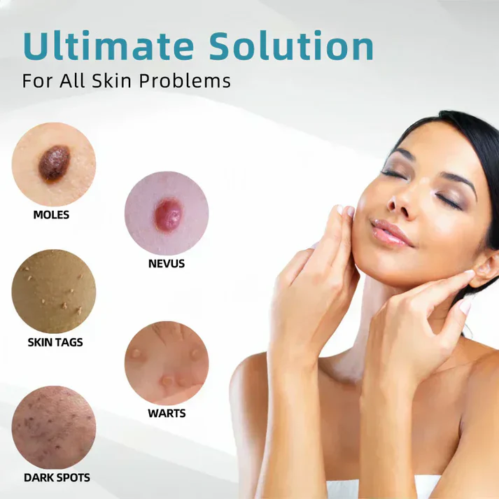 Thekoec® All-in-One CO₂ Laser Eraser Pen | Removes Moles, Warts, Skin Flaws & Pigmentation