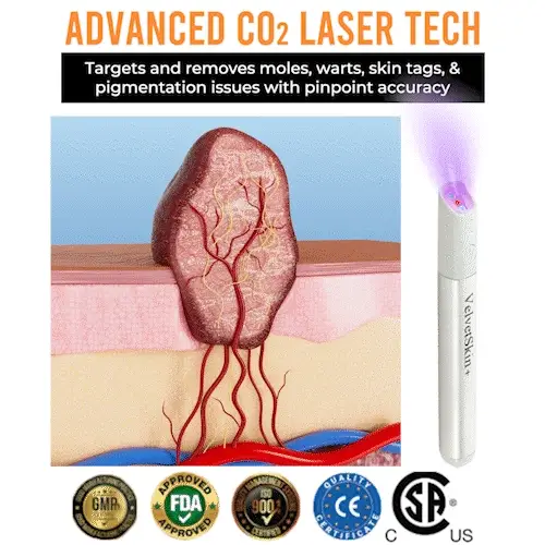 Thekoec® All-in-One CO₂ Laser Eraser Pen | Removes Moles, Warts, Skin Flaws & Pigmentation