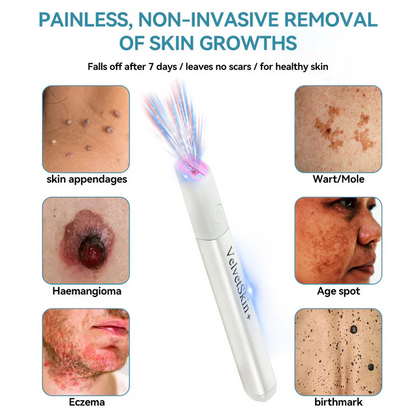 Thekoec® All-in-One CO₂ Laser Eraser Pen | Removes Moles, Warts, Skin Flaws & Pigmentation
