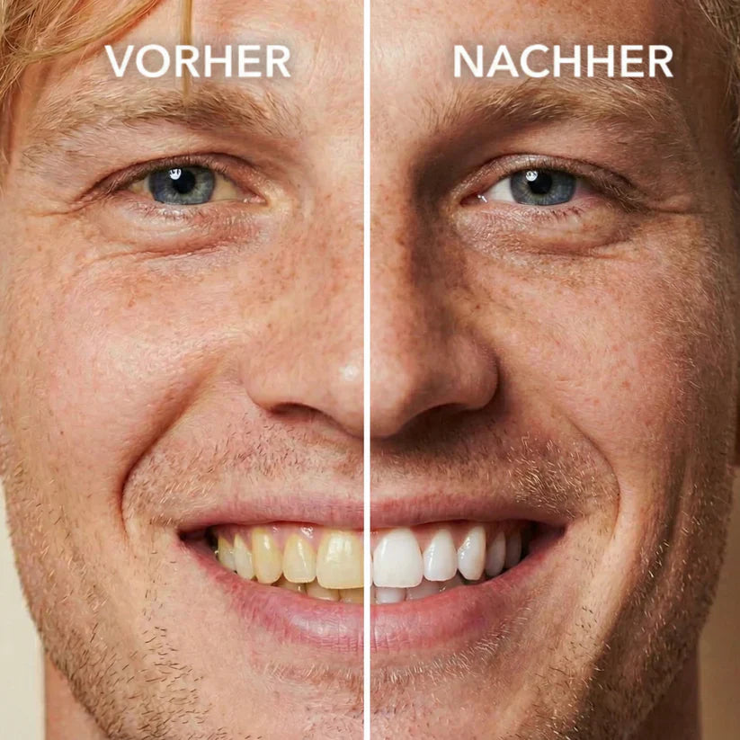 Tooth Polish - Instant Clean Smile